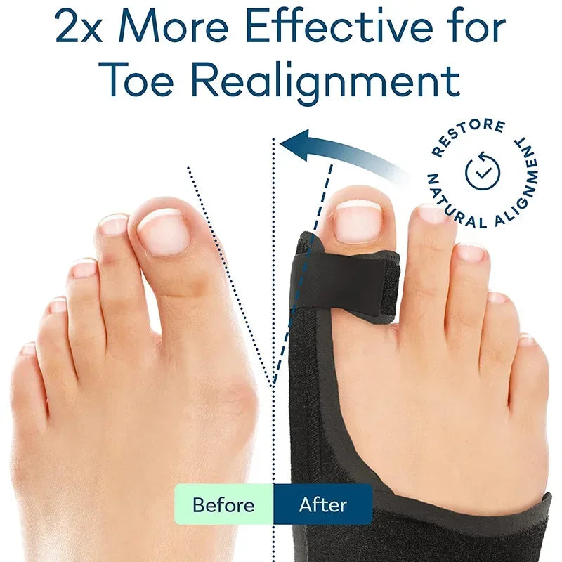Orthopedic Bunion Splint Corrector Big Toe Separator Pain Relief Non-surgical Hallux Valgus Correction Hammer Toe 2026 2026